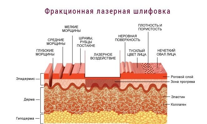 Как определить косоглазие у ребенка 👀 Информационный портал Детское зрение