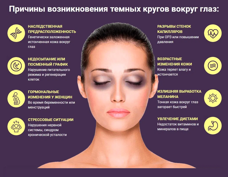 Темные круги под глазами | Решение проблем в клинике BeautyWay Clinic