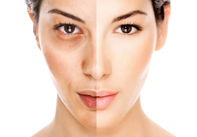 Лазерное отбеливание кожи: цена процедуры в Москве | Осветление кожи лица  лазером в клинике BeautyWay Clinic