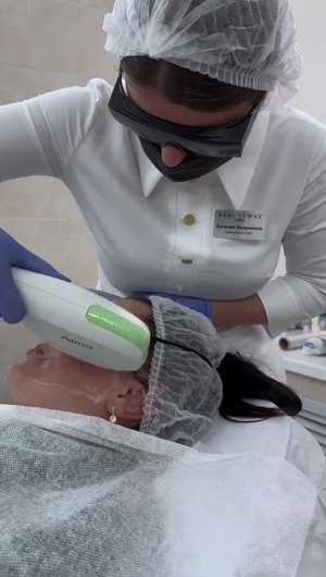Фотоомоложение Harmony XL Pro