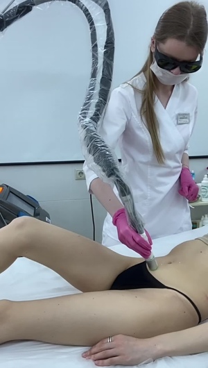 Лазерная эпиляция живота