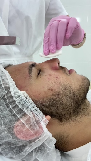 Чистка лица для мужчин