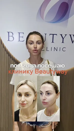 Подтяжка лица отзывы, результат&nbsp;до&nbsp;и&nbsp;после.