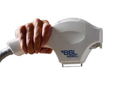 Фотоомоложение тела BBL Forever Body — фото 1