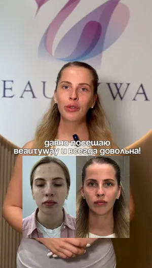 Контурная пластика лица отзывы, результат&nbsp;до&nbsp;и&nbsp;после.