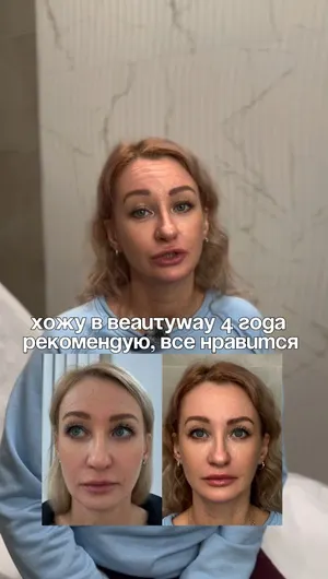 Контурная пластика отзывы, результат&nbsp;до&nbsp;и&nbsp;после.