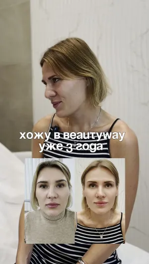 Фотоомоложения, ботулинотерапия отзывы, результат&nbsp;до&nbsp;и&nbsp;после.