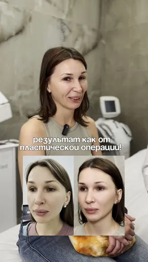 Комплексное омоложение отзывы, результат&nbsp;до&nbsp;и&nbsp;после.