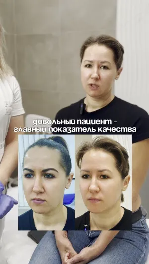 Биоревитализация отзывы, результат&nbsp;до&nbsp;и&nbsp;после.