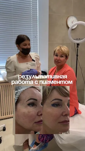 Фотоомоложение лица отзывы, результат&nbsp;до&nbsp;и&nbsp;после.