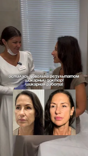 Увеличение губ, коррекция овала лица отзывы, результат&nbsp;до&nbsp;и&nbsp;после.