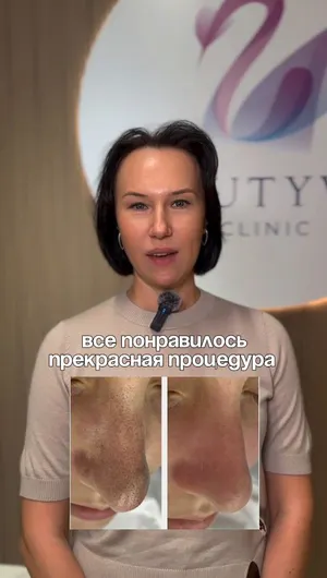 Чистка лица отзывы, результат&nbsp;до&nbsp;и&nbsp;после.