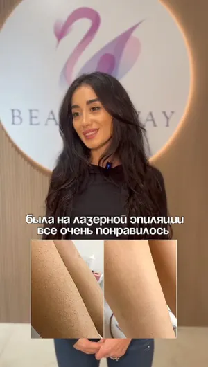 Лазерная эпиляция Deka отзывы, результат&nbsp;до&nbsp;и&nbsp;после.