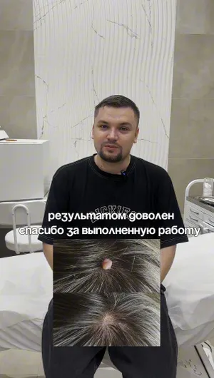 Удаление новообразования отзывы, результат&nbsp;до&nbsp;и&nbsp;после.