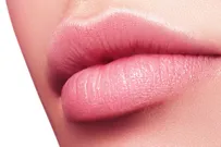 Удаление филлера из губ