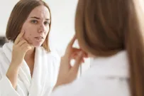 Почему после чистки лица появляются прыщи и как этого избежать