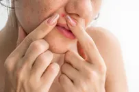 Подкожные прыщи: причины и как убрать