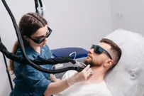 Лазерная эпиляция для мужчин