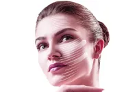 SMAS лифтинг лица и тела на аппарате Ultraformer 3