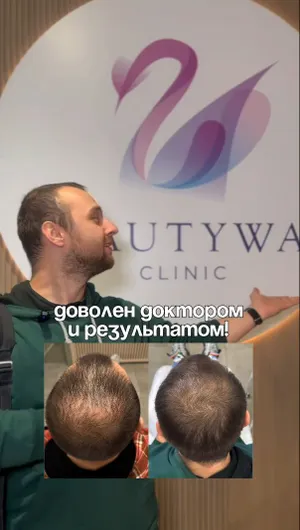 Мезотерапия кожи головы отзывы, результат&nbsp;до&nbsp;и&nbsp;после.