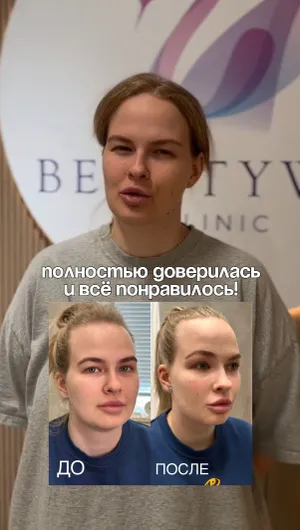 Контурная пластика, липолитики отзывы, результат&nbsp;до&nbsp;и&nbsp;после.