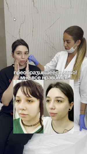 Контурная пластика лица отзывы, результат&nbsp;до&nbsp;и&nbsp;после.